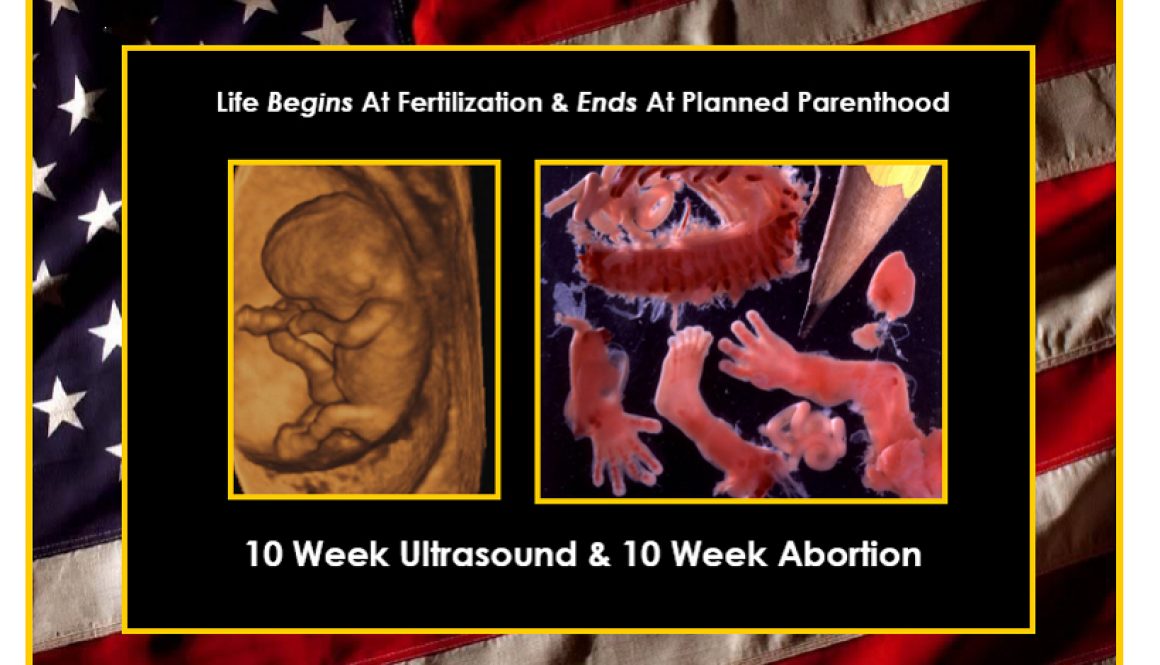 New Sign: Life Begins at Fertilization and Ends at Planned Parenthood