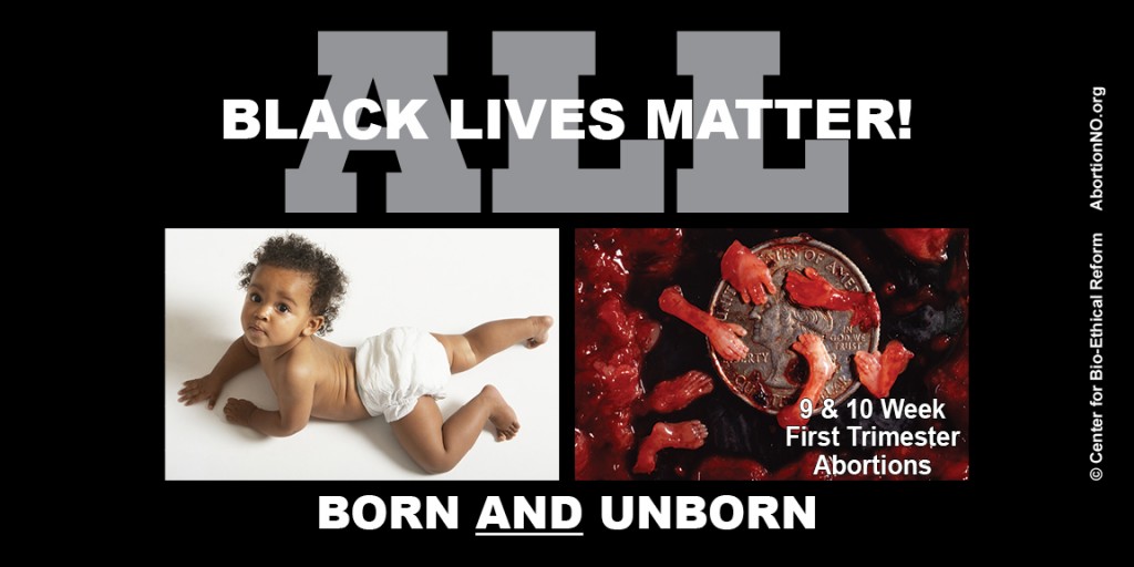 LowRes Black Focus - All Lives Matter